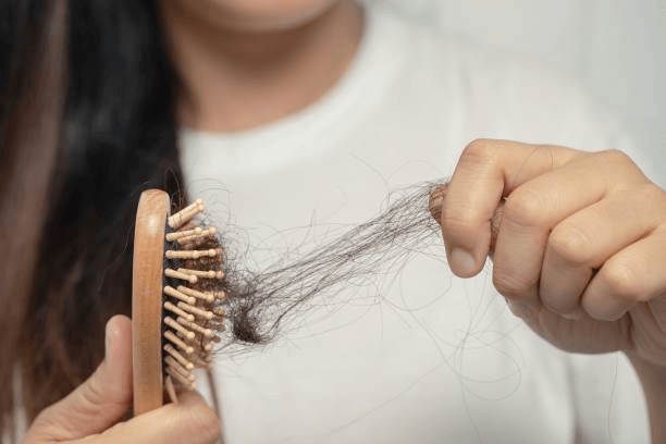 How Can Hair Loss Be Treated?